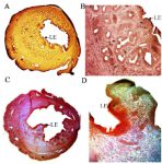 Figure 1. Immunohistochemistry of PCNA in cyclic control (A &amp; B) and cyclic extract treated (C &amp; D) mice. PCNA expression (arrow head) is found in the endometrial stromal cells (S) and luminal epithelium (LE). Original magnification: A &amp; C -5X: B &amp; D -40X