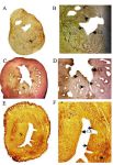 Figure 2. Immunohistochemistry of PCNA in OVX-vehicle treated (control) (A &amp; B), OVX-E2 treated (C &amp; D) and OVX- extract treated (E &amp; F) mice. PCNA expression (arrow head) is found in the endometrial stromal cells (S) and luminal epithelium (LE). Original magnification: A, C &amp; E -5X: B, D &amp; F -40X