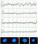 Figure 1. Array CGH profiles of OAT patients (A-D) and different types of aneuploidy in OAT sperm population as assessed by FISH (E-G). A) A genomic profile with complex abnormality for chromosomes -1+3+8-9+10-11+ 13+ 16-18+21 in patient 2. B) Single chromosomal aneuploidy of +20 in patient 3. C) A genomic profile with sex chromosome aneuploidy (Gain of Y) in patient 5. D) A genomic profile with gain of chromosome 19 and sex chromosome aneuploidy (Gain of X/Y) in patient 4. E) Right, a sperm with three signals for chromosome 3 (Red) and normal signal for chromosome 16 (Aqua) and left, a normal sperm with single signals for both chromosomes in patient 2. F) Double disomy for chromosomes 12 (Green) and 20 (Red) and normal signal for chromosome 10 in patient 3. G) Disomy for chro-mosome 10 (Aqua) and normal signals for chromosomes 12 (Green) and 20 (Red) in patient 3