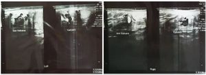 Figure 3. Ultrasound of left testis (Left) and right testis (Right)