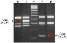 Figure 4. Microdeletion of the patient (P=patient; N=normal; M=marker)