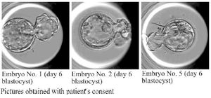 Figure 1. Pictures of the obtained blastocysts