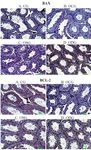 Figure 1. BAX expressions in the testis tissue; A) Negatif expression, B) +1 expression, C) +2 expression, D) +3 ex-pression. BCL-2 expressions in the testis tissue; A) +3 ex-pression, B) Negatif expression, C) +1 expression, D) +1 expression