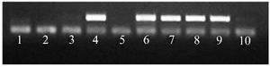 Figure 3. Electrophoresis for amplification products of -511C&gt;T IL-1&beta; gene. Wells 1 and 2 are negative controls. The wells with odd numbers contain amplification products after PCR with primers of the normal allele. In contrast, the wells with even numbers contain amplification products after PCR with primers of the mutant allele. The wells 3-4, 5-6, 7-8, 9-10 contain amplification products for one DNA sample. The homozygous genotype IL-1&beta; -511CC is observed in wells 9 and 10. The homozygous genotype IL-1&beta; -511TT is observed in wells 3-4 and 5-6 while the heterozygous genotype IL-1&beta; -511CT is detected in wells 7 and 8