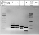 Figure 4. Y chromosome microdeletion study: 1.5% agarose gel image of the specimen for Y chromosome microdeletion analysis by PCR. Two different loci for AZFa, AZFb and AZFc along with SRY and ZFY (Control) were used for analysis along with a positive control for AZFa microdeletion.
Lane 1 and 7: DNA ladder (250 bp plus)
Lane 2: Positive control for YMD (AZFa loci-SY86&ndash;318 bp)
Lane 3: PCR product for ZFY(495 bp) and SY86 (318 bp) [AZFa locus]
Lane 4: PCR product for SRY (472 bp) and SY134 (301 bp) [AZFb locus]
Lane 5: PCR product for SY254 (380 bp) [AZFc locus] and SY127 (274 bp) [AZFb]
Lane 6: PCR product for SY84 (326 bp) [AZFa locus] and SY255 (123 bp) [AZFc locus]
Lane 8: No template control