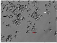 Figure 2. Cumulus cells&nbsp; obtained after decumulation. Note the difference of cumulus cells (Black arrow) from lysed cumulus cells (White arrow) and erythrocytes (Red arrow) prior to sample tubing for genetic analysis