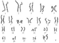 Supplemental Figure 1. Normal female chromosome complement (46, XX) and banding pattern in standard blood chromosome analysis