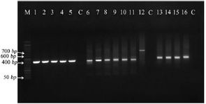 Figure 4. Agarose gel electrophoresis for mtDNA PCR pro-ducts. Samples 1-5 for mtDNA confirmation using (F1-R1) mtDNA primers (Bands sizes of 414 bp). Samples 6-11: bands of 406 bp size for confirmation of 7599 bp deletion using (F4-R3) 7599 bp primers. Sample 12 indicates a band of 756 bp for the confirmation of 7599-bp deletion using (F2-R3)7599 bp primers. The last samples 13-16 indicate the bands of 555 bp for the confirmation of the 7345-bp deletion using (F5-R4) 7345-bp primers. M and C indicated DNA marker and nega-tive controls, respectively