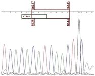 Figure 5. Sequencing result for sperm mtDNA PCR product for 7599 bp mtDNA deletion. The nucleotide sequence inside the red box indicated the seven nucleotide direct repeat at both sides of the deletion as indicated by the numbers above and below the box. ATPase 6 gene is included within the deletion