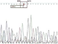 Figure 6. Sequencing result for sperm mtDNA PCR product for 7345 bp mtDNA deletion. The red arrow indicates the site of the deletion breakpoint. ATPase 6 is included within deletion