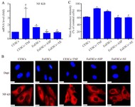 Figure 4. Comparison of NF-kB expression at gene and protein levels between EuESCs and CESCs after treatment with Asp/AE or TNF-&alpha;, respectively, A) total extracted RNA of the cells was analyzed by RT&ndash;PCR. Quantification was performed using the ratio of the target bands relative to GAPDH. The highest levels of NF-kB were presented in TNF-&alpha; treated CESCs and then EuESCs. Treatment with Asp or AE reduced the expression levels up to control, B) immunofluorescence analysis of the NF-kB protein expression in endometrial cells at different groups. NF-kB protein was distributed in the cytoplasm of the cells. The nuclei were stained with DAPI (Blue), C) representative chart for NF-kB protein expression. The protein values followed the same pattern of gene expression in different groups. Data are presented as mean&plusmn;SD. 
* Significant difference with the control, # Significant difference with the untreated group (p&le;0.05), magnification&times;400