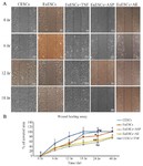 Figure 8. Migratory behavior in EuESCs of patients with stage IV endometriosis under Asp or AE treatment with in vitro wound healing assay, A) microscopic images of migration (Magnification&times;100). ESCs were cultured to 100% confluence and the in vitro repair of wounded cells was checked after 0, 6, 12, 18, 24 and 48 hr, B) the statistical curve of calculated migration distance showing reduced capacity of EuESCs for migration compared with CESCs. Treatment with Asp or AE further decreased this capacity in EuESCs. Statistical analysis was performed at 24 hr in which the CESCs closed the wound