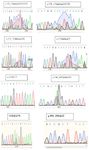 Figure 3. Sequence chromatogram of somatic mutations in MED-12 in and around codon 58