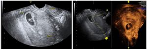 Figure 5. 2D and 3D USG view of the CSEP