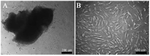 Figure 1. Cell isolation from ovarian cortical tissue. A) 5 days and, B) 20 days after human ovarian tissue culture in the culture plate