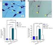 Figure 2. A) Photomicrograph of the DNA fragmentation index and sperm chromatin maturation, 100X. Sperm DNA fragmentation (arrowhead) and, healthy sperm (arrow), and B) Mature chromatin (arrow) and immature chromatin (arrowhead). Mean&plusmn;SD of the percentage of sperm DNA fragmentation and sperm with immature chromatin in the study groups (**** p&lt;0.0001)
