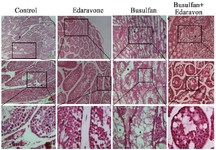 Figure 5. The effect of edaravone on the total number of spermatogenic cells in busulfan-induced mice. Photomicrograph of seminiferous tubules stained with H&amp;E (4X, 10X, and 40X, respectively) in different groups. Empty seminiferous tubule (star)
