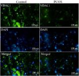 Figure 1. VDAC1 protein levels were obtained by immunocytochemistry where green fluorescence intensities indicated cytoplasmic VDAC1 and blue DAPI fluorescence showed nuclear counterstain.&nbsp; Green and blue intensities were merged to obtain intensity ratio of green/blue fluorescence corresponding to the relative cytoplasmic VDAC1 levels and quantified with ImageJ software
