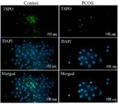 Figure 2. TSPO protein levels were obtained by immunocytochemistry where green fluorescence intensities indicated cytoplasmic TSPO and blue DAPI fluorescence showed nuclear counterstain.&nbsp; Green and blue intensities were merged to obtain intensity ratio of green/blue fluorescence corresponding to the relative cytoplasmic TSPO levels and quantified with ImageJ software
