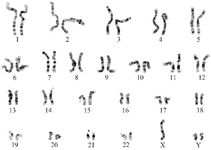 Figure 1. The karyogram of the 47,XYY patient with the homozygous gr/gr AZFc partial deletion