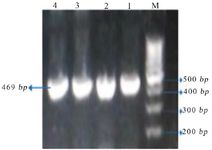 Figure 1. Agarose gel electrophoresis stained by safe stain after PCR amplification of VEGFR1. "M" represents "Marker". The size of PCR product was 469 bp
