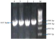 Figure 1. Agarose gel electrophoresis stained by safe stain after PCR amplification of VEGFR1. "M" represents "Marker". The size of PCR product was 469 bp
