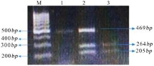 Figure 2. PCR-RFLP products. M=Molecular marker, TT= 469 bp (lane 1), TC=205, 264, 469 bp (lane 2), and CC=205 and 264 bp (lane 3)
