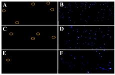 Figure 4. Detection of DNA fragmentation using the TUNEL assay with fluorescence microscopy. Sperm cells stained with DAPI (blue) were counted first, followed by cells that emitted red fluorescence (TUNEL-positive, highlighted with yellow circles); (A, B) sperm from unprocessed semen, (C, D) sperm obtained using density gradient centrifugation, and (E, F) sperm obtained using the microfluidic method. TUNEL, terminal deoxynucleotidyl transferase dUTP nick-end labeling
