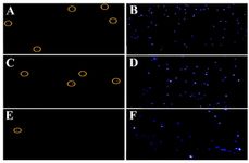 Figure 4. Detection of DNA fragmentation using the TUNEL assay with fluorescence microscopy. Sperm cells stained with DAPI (blue) were counted first, followed by cells that emitted red fluorescence (TUNEL-positive, highlighted with yellow circles); (A, B) sperm from unprocessed semen, (C, D) sperm obtained using density gradient centrifugation, and (E, F) sperm obtained using the microfluidic method. TUNEL, terminal deoxynucleotidyl transferase dUTP nick-end labeling
