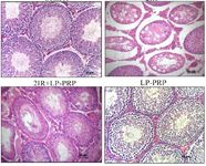 Figure 1. Morphological study of the testes at the 12th week of the experiment in the groups of control, irradiation (2IR), irradiation+LP-PRP (2IR+LP-PRP), and LP-PRP. Hematoxylin and eosin stain, magnification &times;200
