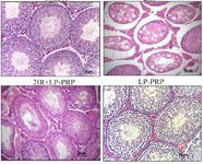 Figure 1. Morphological study of the testes at the 12th week of the experiment in the groups of control, irradiation (2IR), irradiation+LP-PRP (2IR+LP-PRP), and LP-PRP. Hematoxylin and eosin stain, magnification &times;200
