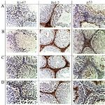 Figure 2. Seminiferous tubules at week 12 of the experiment. Immunohistochemical reactions with antibodies of Ki-67, Bcl-2, p53; core staining with hematoxylin, magnification &times;400. A&ndash;control; B&ndash;after electron irradiation at a dose of 2 Gy (2IR); C&ndash;after electron irradiation at a dose of 2 Gy and administration of platelet-rich plasma (2IR+LP-PRP); and D&ndash;after administration of platelet-rich plasma (LP-PRP)
