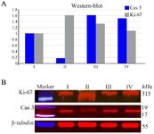 Figure 3. Western blotting of Ki-67 and caspase-3 (Cas 3) proteins in the testes of the control and experimental groups. Three testicular tissue samples from each group were pooled and subjected to western blotting. Ki-67 and caspase-3 expression in testicular tissues was measured as nmol pNA/mg protein C: control (I); 2IR (II); 2IR+LP-PRP (III); and LP-PRP (IV). &beta;-tubulin immunostaining was used as a standard. A&ndash;densitometric analysis of western blotting, B&ndash;visualization (immunochemiluminescence)
