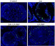 Figure 4. TUNEL and confocal microscopy of the testes on the 84th day. The luminescence was observed mainly in the basal compartment of the tubules and in the Leydig cells. Magnification &times;400
