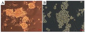 Figure 4. Differentiated (A) and undifferentiated (B) spermatogonia in bright field (scale bar 50 &mu;m)