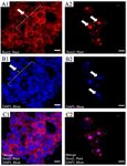 Figure 6. The pattern of Sox2 expression with immunocytochemistry in differentiated and undifferentiated cells of testis biopsy using confocal scanning UV‐laser microscope. This Figure shows the expression of Sox2 in differentiated and undifferentiated cells under in vitro conditions. A) The expression of Sox2 in 1) undifferentiated and 2) differentiated spermatogonia. B1, 2) The DAPI staining for the nuclear cells and C1, 2) The merged images (scale bar 10 &mu;m)