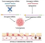 Figure 2. MicroRNAs act as oncogenes or tumor sup-pressors in cancer. Overexpression of microRNAs may block tumor suppressors or associated genes involved in cell dif-ferentiation, leading to tumor growth, angiogenesis, and invasion (oncogenes). MicroRNAs are involved in tumor invasion, metastasis, EMT, and systemic circulation
