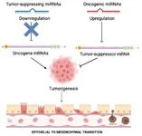 Figure 2. MicroRNAs act as oncogenes or tumor sup-pressors in cancer. Overexpression of microRNAs may block tumor suppressors or associated genes involved in cell dif-ferentiation, leading to tumor growth, angiogenesis, and invasion (oncogenes). MicroRNAs are involved in tumor invasion, metastasis, EMT, and systemic circulation
