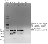 Figure 3. Agarose gel (1.8%) image of Y chromosome microdeletion analysis by multiplex PCR
Lane 1: DNA ladder (100 bp). Lane 2: Negative control for ZFY-495 bp, SY84 (326 bp) [AZFa locus], SY134 (301 bp) [AZFb locus], SY127 (274 bp) [AZFb locus]. Lane 3: Negative control for SRY&ndash;472 bp, SY254 (400 bp) [AZFc locus], SY86 (320 bp) [AZFa locus], SY255 (126 bp) [AZFc locus]
Lane 4:&nbsp; Test sample; two bands indicating presence of ZFY- 495 bp, SY84 (326 bp) [AZFa locus], and absence of two bands indicating deletion of SY134 (301 bp) [AZFb locus], SY127 (274 bp) [AZFb locus]. Lane 5: Test sample; two bands indicating presence of SRY&ndash;472 bp, SY86 (320 bp) [AZFa locus], and absence of two bands indicating deletion of SY254 (400 bp), and SY255 (126 bp) [AZFc locus]. Lane 6: No template control; no bands indicating absence of any kind of nucleic acid contamination
