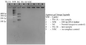 Figure 4. Agarose gel (1.8%) image of Y chromosome microdeletion (AZFc region specific) analysis by multiplex PCR
Lane 1: Test sample; absence of four bands indicating deletion of SY254 (400 bp), SY160 (236 bp), SY145 (143 bp), and SY 255 (126 bp) [AZFc locus]. Lane 2: DNA ladder (100 bp). Lane 3: Negative control; presence of four bands indicating no deletion of SY254 (400 bp), SY160 (236 bp), SY145 (143 bp), and SY 255 (126 bp) [AZFc locus]. Lane 4:&nbsp; Test sample; absence of four bands indicating deletion of SY254 (400 bp), SY160 (236 bp), SY145 (143 bp), and SY 255 (126 bp) [AZFc locus]. Lane 5: No template control; no bands indicating absence of any kind of nucleic acid contamination
