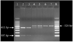 Figure 1. Gel image showing FSHR G2039A polymorphism
Lane 1: 100 bp ladder, lanes 2 and 3: GG genotype (wild type) at 413/107 bp, lanes 4 and 5: GA genotype (heterozygous) at 520/413/107 bp, lanes 6 and 7: AA genotype (mutant) at 520 bp, and lane 8: 100 bp ladder
