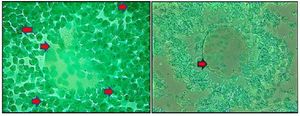 Figure 1. Comparison of Cdk 1 expression images in the oocyte. (Left) control group (T0); (Right) treatment group (T1). The red arrow indicates the presence of Cdk 1 ex-pression in oocytes characterized by brown chromogen in the cytoplasm and cell nucleus. ICC. Original magnification at x1000
