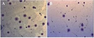 Figure 1. The effects of freezing at 20&deg;C, as assessed by Halosperm technique, on DFI before cryopreservation (A) and after thawing (B)