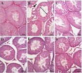 Figure 1. H&amp;E-stained histology of testis showing (A) Sham group, (B) torsion/detorsion (T/D) group, (C) vitamin E group (20 mg/kg), (D) torsion/ detorsion (T/D) group with a therapeutic dose of 300 mg/kg (T/D+Cit300), (E) torsion/ detorsion (T/D) group with a therapeutic dose of 600 mg/kg (T/D+Cit600), and (F) torsion/detorsion (T/D) group with a therapeutic dose of 900 mg/kg (T/D+Cit900). Thick black arrow: loss of integrity; Thin black arrow: edema - increased distance between seminiferous tubules; Black double-headed arrow: diameter of seminiferous tubule. Magnification: 20x and scale bar:100 &micro;m