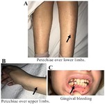 Figure 1. Clinical presentation of the patient