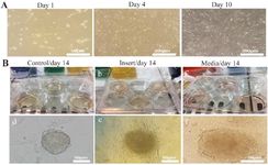 Figure 1. Characterization of SSCs in the experimental groups. A (a-c): SSCs were cultured in experimental systems, and the cells were evaluated on day 14. A (d-f): spermatogonial stem-like cell colonies were observed under inverted microscopy. In conditioned media and indirect mesh-based co-culture groups, most of the colonies began to disperse. B: Isolated from the amniotic membrane, MSCs were transferred to flask 25 and incubated for ten days. After 1, 4, and 10 days of cultivation, the images were captured. In all experimental groups, 1&Iacute;105 SSCs were seeded in a six-well plate containing SSCs
