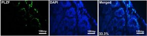 Figure 2. Immunohistochemistry staining. Plzf expression in mouse testes was evaluated by immunohistochemical labeling. All cell nuclei were stained with DAPI (blue), and Plzf-positive cells are shown in green. Scale bars: 100 &micro;m