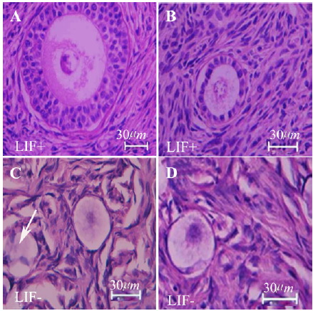 Figure 1. Light microscopy of human ovarian cortex after 14 days of in vitro culture; samples stained by haematoxylin and eosin. The morphology of follicles in the non-vitrified&ndash;LIF+ group (A), vitrified&ndash;LIF+ (B) non-vitrified&ndash;LIF&ndash; (C) and vitrified&ndash;LIF&ndash; (D) groups is shown. Damaged follicle with disorganized granulosa cells was seen (Arrow head)