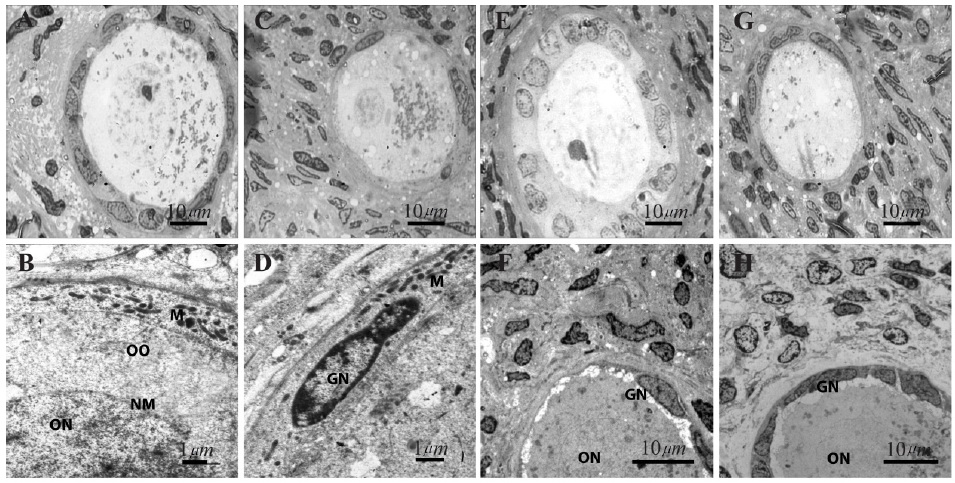 Figure 2. Ultrastructure of human ovarian follicles after 14 days of in vitro culture in the presence and absence of LIF. (A) Non-vitrified&ndash;LIF+ group; (B) Vitrified&ndash;LIF+; (C) Non-vitrified&ndash;LIF&ndash;; (D) Ditrified&ndash;LIF&ndash;; (E&ndash;H) High magnification images of previous groups, respectively. The chromatin in oocytes and follicular cells was normal in all groups. ON: Oocyte nucleus; NM: Oocyte nuclear membrane; OO: Ooplasm; GN: Granulosa cell nucleus; M: Mitochondria