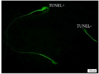 Figure 1. TUNEL staining of spermatozoa; TUNEL+ indicates sperm cells with abnormal DNA and TUNEL- indicates sperm cells with normal DNA (&times;100 eyepiece magnification)